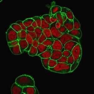 Immunofluorescent analysis of PFA fixed MCF-7 cells stained with Anti-CD47 Antibody [IAP/964 + B6H12.2] followed by Goat Anti-Mouse IgG (CF&#174; 488) (Green). Nuclear counterstain is RedDot.