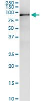 Anti-MPP3 Polyclonal Antibody Pair