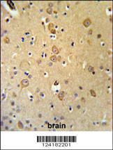 Anti-LRRTM1 Rabbit Polyclonal Antibody (FITC (Fluorescein Isothiocyanate))