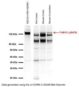 Anti-TrkB (phospho-Ser478) Rabbit Polyclonal Antibody