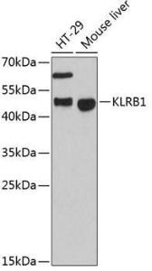 Western blot analysis of extracts of various cell lines, using Anti-CD161 Antibody (A10030) at 1:3,000 dilution. The secondary antibody was Goat Anti-Rabbit IgG H&L Antibody (HRP) at 1:10,000 dilution.