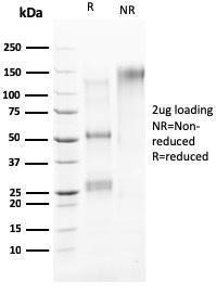 SDS-PAGE analysis of Anti-HER4 Antibody [ERBB4/2581] under non-reduced and reduced conditions; showing intact IgG and intact heavy and light chains, respectively SDS-PAGE analysis confirms the integrity and purity of the antibody