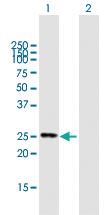 Anti-FIGLA Mouse Polyclonal Antibody