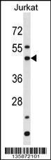 Anti-BAG5 Rabbit Polyclonal Antibody (AP (Alkaline Phosphatase))