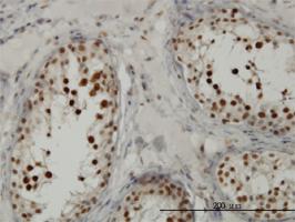 Anti-TCF19 Mouse Monoclonal Antibody [clone: 6D8]