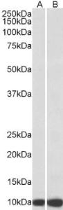 EB12836 (0.3 µg/ml) staining of HeLa (A) and HepG2 (B) lysates (35 µg protein in RIPA buffer). Primary incubation was 1 hour. Detected by chemiluminescence.