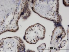 Anti-ZNF232 Mouse Monoclonal Antibody [clone: 1F8]