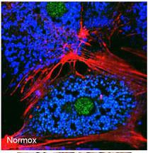 Anti-BNIP3 Rabbit Polyclonal Antibody