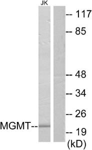 Western blot analysis of lysates from Jurkat cells using Anti-MGMT Antibody. The right hand lane represents a negative control, where the antibody is blocked by the immunising peptide.