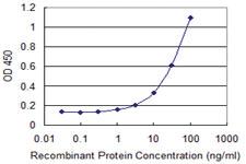 Anti-ZNF232 Mouse Monoclonal Antibody [clone: 1F8]