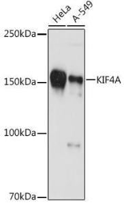 Western blot analysis of extracts of various cell lines, using Anti-KIF4A/KIF4 Antibody [ARC1405] (A307453) at 1:1000 dilution. The secondary Antibody was Goat Anti-Rabbit IgG H&L Antibody (HRP) at 1:10000 dilution. Lysates/proteins were present at 25 µg per lane