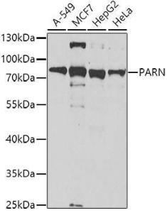 Anti-PARN Antibody (A10034)