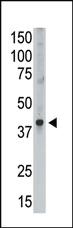 Anti-MAGEA9 Rabbit Polyclonal Antibody