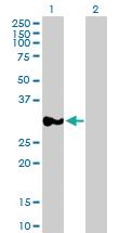 Anti-RPRD1A Mouse Polyclonal Antibody