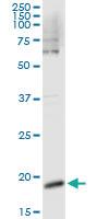 Anti-CSF3 Antibody Pair