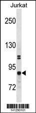 Anti-CHUK Rabbit Polyclonal Antibody (AP (Alkaline Phosphatase))