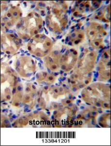 Anti-COPS2 Rabbit Polyclonal Antibody