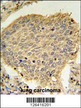 Anti-TPC6A Rabbit Polyclonal Antibody (FITC (Fluorescein Isothiocyanate))