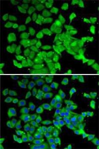 Immunofluorescence analysis of MCF7 cells using Anti-PARN Antibody (A10034). DAPI was used to stain the cell nuclei (blue)