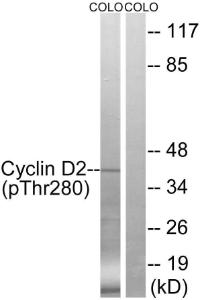 Western blot analysis of lysates from COLO205 cells treated with EGF 200ng/ml 30' using Anti-Cyclin D2 (phospho Thr280) Antibody The right hand lane represents a negative control, where the antibody is blocked by the immunising peptide