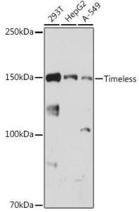 Western blot analysis of extracts of various cell lines, using Anti-Timeless Antibody [ARC1827] (A305781) at 1:1,000 dilution. The secondary antibody was Goat Anti-Rabbit IgG H&L Antibody (HRP) at 1:10,000 dilution.