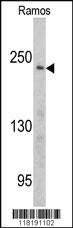 Anti-PCM1 Rabbit Polyclonal Antibody