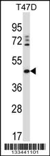 Anti-DEGS1 Rabbit Polyclonal Antibody