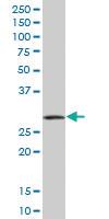 Anti-RPRD1A Mouse Polyclonal Antibody