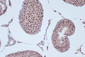 Immunohistochemistry analysis of paraffin-embedded rat testis using Anti-KIF4A/KIF4 Antibody [ARC1405] (A307453) at a dilution of 1:100 (40X lens). Perform microwave antigen retrieval with 10 mM Tris/EDTA buffer pH 9.0 before commencing with IHC staining protocol