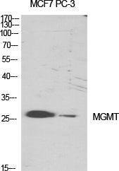 Western blot analysis of various cells using Anti-MGMT Antibody