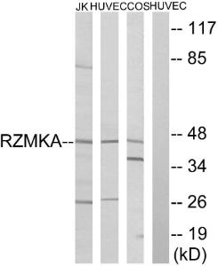 Western blot analysis of lysates from HUVEC, COS, and Jurkat cells using Anti-RIMKA Antibody. The right hand lane represents a negative control, where the antibody is blocked by the immunising peptide