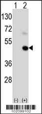 Anti-MAGEA9 Rabbit Polyclonal Antibody