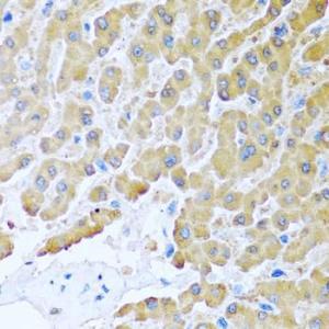 Immunohistochemistry analysis of paraffin-embedded human liver using Anti-MCP2 Antibody (A10037) at a dilution of 1:100 (40x lens). Perform microwave antigen retrieval with 10 mM PBS buffer pH 7.2 before commencing with IHC staining protocol