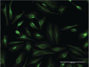 Anti-TAGLN Mouse Monoclonal Antibody [clone: 3A3]