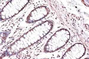 Immunohistochemistry analysis of paraffin-embedded human colon tissue using Anti-KIF4A/KIF4 Antibody [ARC1405] (A307453) at a dilution of 1:100 (40X lens). Perform microwave antigen retrieval with 10 mM Tris/EDTA buffer pH 9.0 before commencing with IHC staining protocol