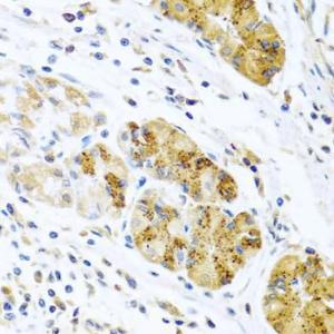 Immunohistochemistry analysis of paraffin-embedded human stomach using Anti-MCP2 Antibody (A10037) at a dilution of 1:100 (40x lens). Perform microwave antigen retrieval with 10 mM PBS buffer pH 7.2 before commencing with IHC staining protocol