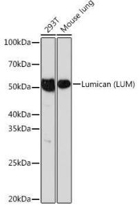 Western blot analysis of extracts of various cell lines, using Anti-Lumican Antibody [ARC0637] (A80621) at 1:1,000 dilution The secondary antibody was Goat Anti-Rabbit IgG H&L Antibody (HRP) at 1:10,000 dilution Lysates/proteins were present at 25 µg per lane