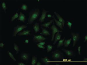 Anti-TCF19 Mouse Monoclonal Antibody [clone: 6D8]