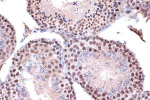 Immunohistochemistry analysis of paraffin-embedded mouse testis using Anti-KIF4A/KIF4 Antibody [ARC1405] (A307453) at a dilution of 1:100 (40X lens). Perform microwave antigen retrieval with 10 mM Tris/EDTA buffer pH 9.0 before commencing with IHC staining protocol