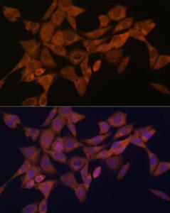 Immunofluorescence analysis of NIH-3T3 cells using Anti-Syntaxin 4 Antibody [ARC2113] (A308390) at a dilution of 1:100 (40x lens). DAPI was used to stain the cell nuclei (blue).