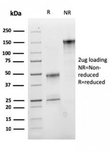 SDS-PAGE analysis of Anti-CD47 Antibody [CD47/2937] under non-reduced and reduced conditions; showing intact IgG and intact heavy and light chains, respectively. SDS-PAGE analysis confirms the integrity and purity of the Antibody