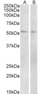 EB11028 (2 µg/ml) staining of Mouse (A) and Rat (B) Small Intestine lysate (35 µg protein in RIPA buffer). Primary incubation was 1 hour. Detected by chemiluminescence.