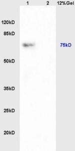 Anti-PAPOL A+B+G Rabbit Polyclonal Antibody