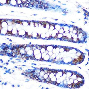 Immunohistochemistry analysis of paraffin-embedded human colon tissue using Anti-Lumican Antibody [ARC0637] (A80621) at a dilution of 1:100 (40x lens) Perform microwave antigen retrieval with 10 mM PBS buffer pH 72 before commencing with IHC staining protocol