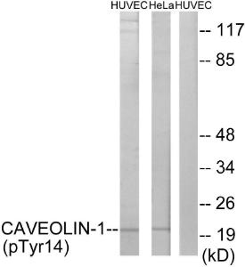 Western blot analysis of lysates from HUVEC cells treated with PMA 125ng/ml 30' and HeLa cells treated with LPS 100ng/ml 30' using Anti-Caveolin-1 (phospho Tyr14) Antibody