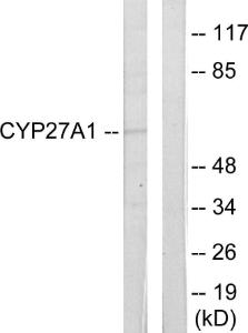 Western blot analysis of lysates from HeLa cells using Anti-Cytochrome P450 27A1 Antibody. The right hand lane represents a negative control, where the Antibody is blocked by the immunising peptide