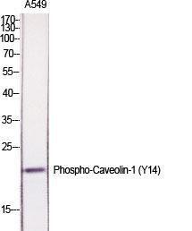 Western blot analysis of various cells using Anti-Caveolin-1 (phospho Tyr14) Antibody