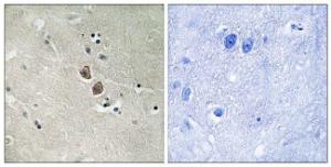 Antibody anti-NPTN 100 µg