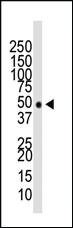 Anti-HDAC11 Rabbit Polyclonal Antibody