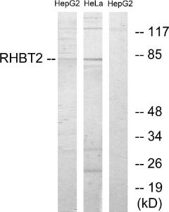 Western blot analysis of lysates from HepG2 and HeLa cells using Anti-RHBT2 Antibody. The right hand lane represents a negative control, where the antibody is blocked by the immunising peptide